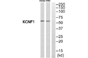 Western blot analysis of extracts from HuvEc cells and K562 cells, using KCNF1 antibody. (KCNF1 Antikörper  (Internal Region))