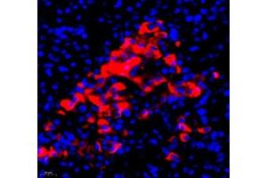Immunofluorescence of paraffin embedded human pancreas using RBP (ABIN7075409) at dilution of 1: 650 (400x lens) (RBP4 Antikörper)