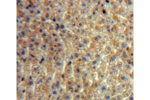 Used in DAB staining on fromalin fixed paraffin-embedded liver tissue