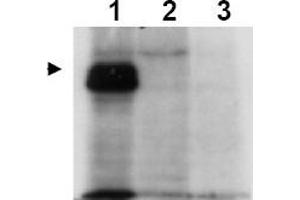 Image no. 1 for anti-MLF1 Interacting Protein (MLF1IP) (Thr78) antibody (ABIN401336) (MLF1IP Antikörper  (Thr78))