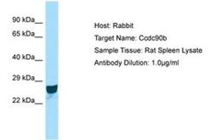 Image no. 1 for anti-Coiled-Coil Domain Containing 90B (CCDC90B) (AA 151-200) antibody (ABIN6749915) (CCDC90B Antikörper  (AA 151-200))
