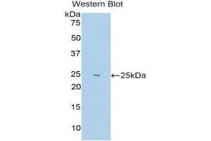Western Blotting (WB) image for anti-Endothelial PAS Domain Protein 1 (EPAS1) (AA 339-541) antibody (ABIN1176134) (EPAS1 Antikörper  (AA 339-541))