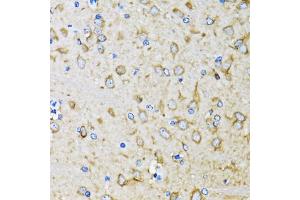 Immunohistochemistry of paraffin-embedded mouse brain using MAP1LC3B antibody (ABIN5974331) at dilution of 1/100 (40x lens).