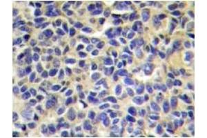 Image no. 1 for anti-Endoplasmic Reticulum Aminopeptidase 1 (ERAP1) antibody (ABIN272255)