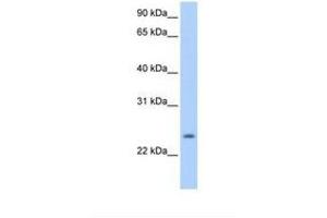 Image no. 1 for anti-PQ Loop Repeat Containing 1 (PQLC1) (AA 161-210) antibody (ABIN6738642) (PQLC1 Antikörper  (AA 161-210))