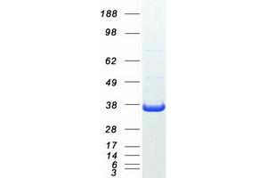 Western Blotting (WB) image for Fumarylacetoacetate Hydrolase Domain Containing 2A (FAHD2A) protein (Myc-DYKDDDDK Tag) (ABIN2720707)