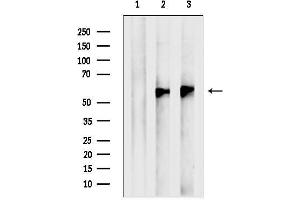 Western blot analysis of lysates from various samples, using ESRRG Antibody.