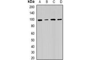 Western blot analysis of RRM1 expression in Hela (A), SW480 (B), mouse testis (C), mouse spleen (D) whole cell lysates. (RRM1 Antikörper)