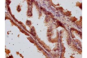 IHC image of ABIN7144227 diluted at 1:500 and staining in paraffin-embedded human prostate tissue performed on a Leica BondTM system. (ANKRD42 Antikörper  (AA 158-377))