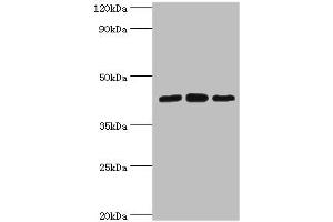Western blot All lanes: Nucleolysin TIA-1 isoform p40 antibody at 2 μg/mL Lane 1: Jurkat whole cell lysate Lane 2: K562 whole cell lysate Lane 3: Hela whole cell lysate Secondary Goat polyclonal to rabbit IgG at 1/10000 dilution Predicted band size: 43, 42, 25 kDa Observed band size: 43 kDa (TIA1 Antikörper  (AA 1-193))