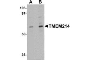 Western blot analysis of TMEM214 in A20 cell lysate with this product at (A) 1 and (B) 2 μg/ml. (TMEM214 Antikörper  (N-Term))