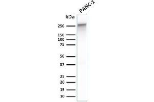 Western Blot Analysis of human PANC-1 cell lysate using Spectrin beta III Mouse Monoclonal Antibody (SPTBN2/1778).