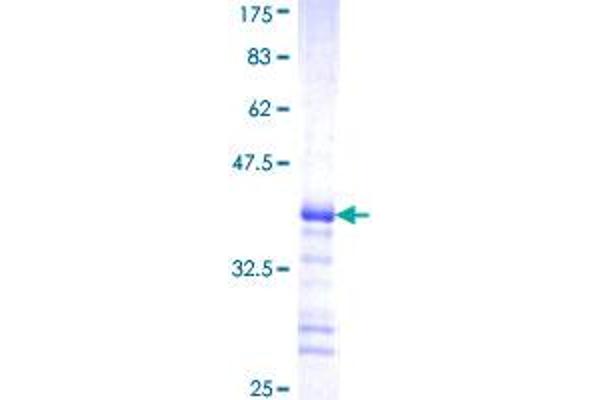 MYLK2 Protein (AA 161-260) (GST tag)