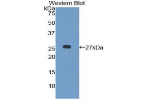 Detection of Recombinant LILRB3, Mouse using Polyclonal Antibody to Leukocyte Immunoglobulin Like Receptor Subfamily B, Member 3 (LILRB3) (LILRB3 Antikörper  (AA 410-631))