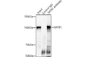Immunoprecipitation (IP) image for anti-SATB Homeobox 1 (SATB1) (AA 484-763) antibody (ABIN6147396)