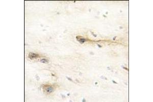 Formalin-fixed and paraffin-embedded human brain tissue reacted with MARK1 Antibody (N-term), which was peroxidase-conjugated to the secondary antibody, followed by DAB staining. (MARK1 Antikörper  (N-Term))