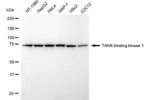 Western blotting analysis using TANK binding kinase 1 antibody (ABIN7800507). (Rekombinanter TBK1 Antikörper)