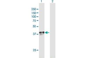 Western Blotting (WB) image for anti-Solute Carrier Family 29 (Nucleoside Transporters), Member 1 (SLC29A1) (AA 1-456) antibody (ABIN515309)