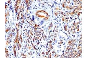 IHC testing of FFPE human uterus with recombinant Caldesmon antibody. (Caldesmon HMW Antikörper)