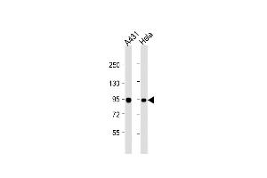 All lanes : Anti-HSPCB Antibody (Center) at 1:1000 dilution Lane 1: A431 whole cell lysate Lane 2: Hela whole cell lysate Lysates/proteins at 20 μg per lane.
