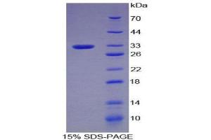 PLG Protein (AA 100-352) (His tag)