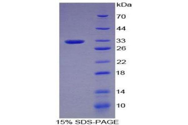 PLG Protein (AA 100-352) (His tag)