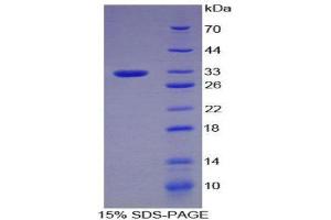 SDS-PAGE (SDS) image for Plasminogen (PLG) (AA 100-352) protein (His tag) (ABIN1880020) (PLG Protein (AA 100-352) (His tag))