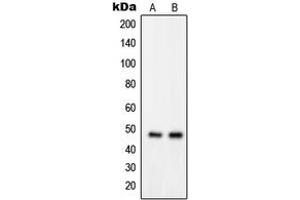 Western blot analysis of GPRIN2 expression in MDAMB435 (A), K562 (B) whole cell lysates.