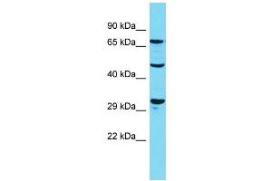 Host: Rabbit Target Name: Dusp7 Sample Type: Rat Pancreas lysates Antibody Dilution: 1.