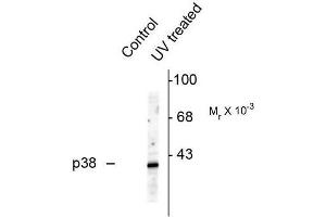 Image no. 1 for anti-Mitogen-Activated Protein Kinase 14 (MAPK14) (pThr180), (pTyr182) antibody (ABIN372694) (MAPK14 Antikörper  (pThr180, pTyr182))
