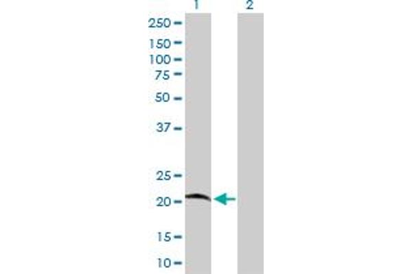 G Substrate Antikörper  (AA 1-155)