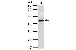 WB Image Sample (30 ug of whole cell lysate) A: Hep G2 , 10% SDS PAGE antibody diluted at 1:1000 (HPD Antikörper)