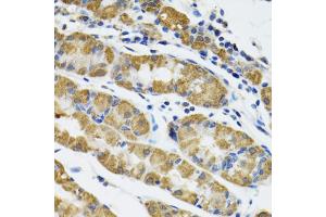 Immunohistochemistry of paraffin-embedded human stomach using HAPLN1 antibody (ABIN5973979) at dilution of 1/100 (40x lens). (HAPLN1 Antikörper)