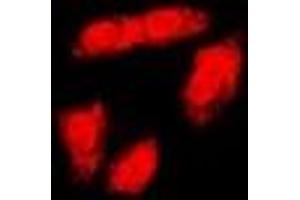 Immunofluorescent analysis of BRCA1 (pS1423) staining in HeLa cells. (BRCA1 Antikörper  (C-Term, pSer1423))