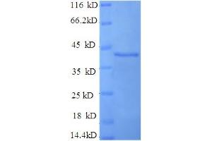 SDS-PAGE (SDS) image for Synaptotagmin I (SYT1) (AA 99-416), (Cytoplasmic Domain), (Cytosolic) protein (His tag) (ABIN5710450) (SYT1 Protein (AA 99-416, Cytoplasmic Domain, Cytosolic) (His tag))