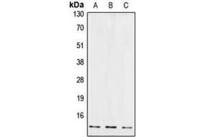 Western blot analysis of Cystatin B expression in JAR (A), EOC20 (B), U87MG (C) whole cell lysates. (CSTB Antikörper  (Center))
