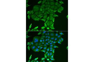 Immunofluorescence analysis of HeLa cells using CD84 antibody (ABIN6132251, ABIN6138235, ABIN6138236 and ABIN6222077). (CD84 Antikörper  (AA 22-225))