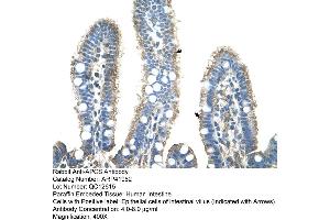 Rabbit Anti-APCS Antibody  Paraffin Embedded Tissue: Human Intestine Cellular Data: Epithelial cells of intestinal villas Antibody Concentration: 4.