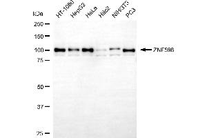 anti-Zinc Finger Protein 598 (ZNF598) antibody