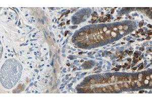 ABIN6274155 at 1/100 staining Mouse intestine tissue by IHC-P.