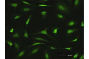 Immunofluorescence of purified MaxPab antibody to AGGF1 on HeLa cell. (AGGF1 Antikörper  (AA 1-714))