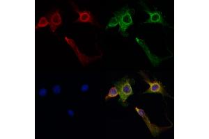 ABIN6260516 and ABIN6267035 staining HepG2 by IF/ICC. (CBP Antikörper  (C-Term))