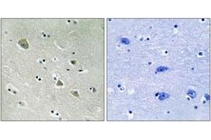 Immunohistochemistry analysis of paraffin-embedded human brain, using PAK1 (Phospho-Ser204) Antibody.