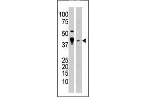 The MBD2 polyclonal antibody  is used in Western blot to detect MBD2 in A-375 cell lysate (lane 1) and mouse brain tissue lysate (lane 2) lysate. (MBD2 Antikörper  (N-Term))