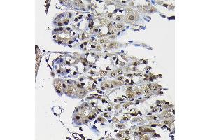 anti-Phosphatase and Tensin Homolog (PTEN) (AA 209-403) antibody