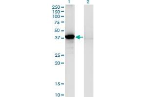 Western Blot analysis of SORD expression in transfected 293T cell line by SORD monoclonal antibody (M03), clone 1C2.