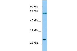 Host: Rabbit Target Name: SPCS3 Sample Type: THP-1 Whole Cell lysates Antibody Dilution: 1. (SPCS3 Antikörper  (Middle Region))