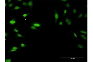 Immunofluorescence of purified MaxPab antibody to SIRT7 on HeLa cell.