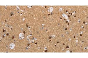 Immunohistochemistry of paraffin-embedded Human brain using KCNG4 Polyclonal Antibody at dilution of 1:40 (KCNG4 Antikörper)