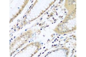Immunohistochemistry of paraffin-embedded Human stomach using WDR48 Polyclonal Antibody at dilution of 1:100 (40x lens). (WDR48 Antikörper)